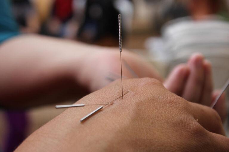 Akupunktur & Lasertherapie